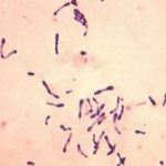 Reportan 25 muertos por brote de difteria en Nigeria