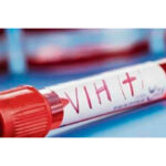 Avances en la atención y prevención del VIH en Nicaragua