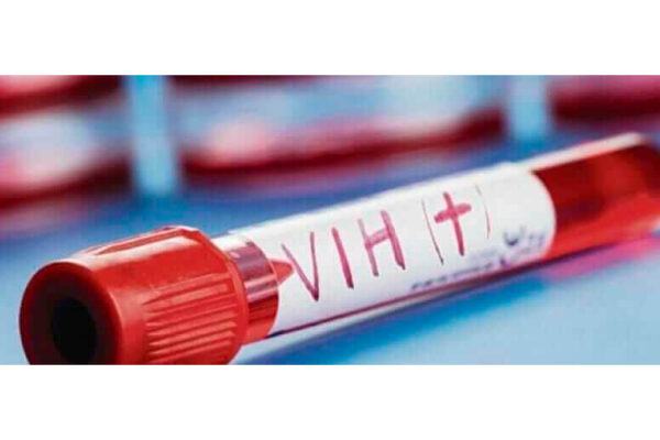 Avances en la atención y prevención del VIH en Nicaragua