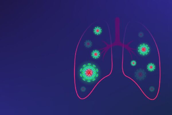 Reporte semanal del Covid-19: Brindan atención y seguimiento responsable a 15 nicaragüenses